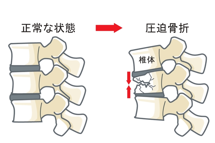 病気に潜む 危険な腰痛の種類と原因 津田沼ドレミ整体院